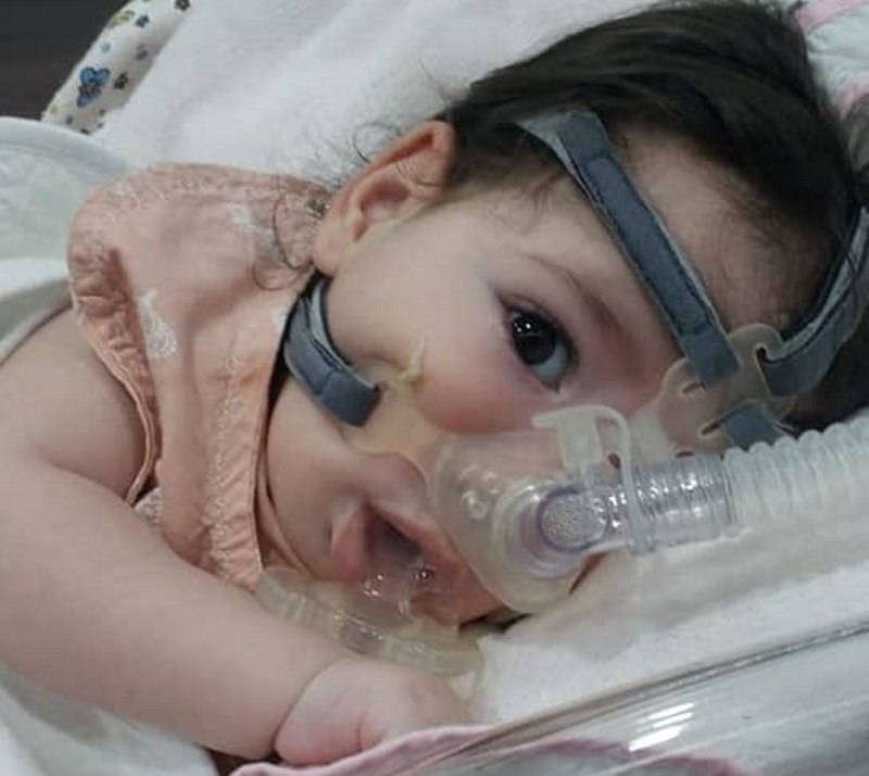 Emma em tratamento - campanha de doação